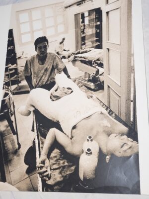 South Vietnam, girl in hospital undergoing operation traumatising photo by Michael Joseph